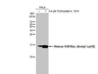 Western Blot: HIST1H3A [ac Lys18] Antibody [NBP2-43535]